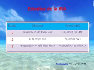 Estadios de la IRA

Am J Kidney Dis. 2013 May;61(5):673-85

 