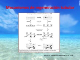 Mecanismos de regeneración tubular

Journal of Translational Medicina (2011) 9: 13

 