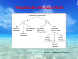 Terapias de remplazo renal

The Lancet: Global Kidney Disease. May 2013

 