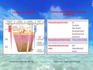 Causas de oliguria

Kidney Intern. 2011; 80: 699 -701

Causas que alteran el valor de
cretinina

Kidney inter., Suppl. 2013; 3: 1–150.

 