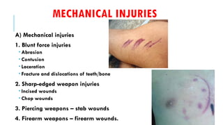 Injuries. forensic medicine pptx | PPTX