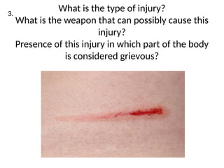 INJURIES IN FORENSIC MEDICINE 1 (1).pptx