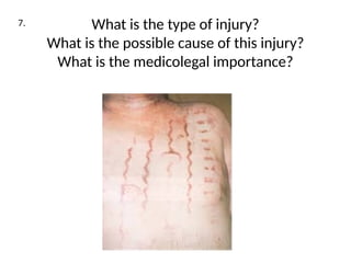 INJURIES IN FORENSIC MEDICINE 1 (1).pptx