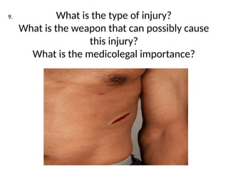 INJURIES IN FORENSIC MEDICINE 1 (1).pptx