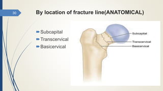 Injuries around hip joint | PPTX