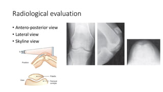 Radiological evaluation
• Antero-posterior view
• Lateral view
• Skyline view
 