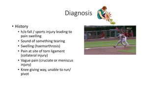 Diagnosis
• History
• h/o fall / sports injury leading to
pain swelling
• Sound of something tearing
• Swelling (haemarthrosis)
• Pain at site of torn ligament
(collateral injury)
• Vague pain (cruciate or meniscus
injury)
• Knee giving way, unable to run/
pivot
 