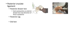 • Posterior cruciate
ligament
• Posterior drawer test
• Same perquisites as anterior
drawer but now direction of
force is posterior
• Posterior sag
• Dial test
 