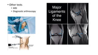 • Other tests
• MRI
• Diagnostic arthroscopy
 