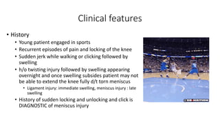 Clinical features
• History
• Young patient engaged in sports
• Recurrent episodes of pain and locking of the knee
• Sudden jerk while walking or clicking followed by
swelling
• h/o twisting injury followed by swelling appearing
overnight and once swelling subsides patient may not
be able to extend the knee fully d/t torn meniscus
• Ligament injury: immediate swelling, meniscus injury : late
swelling
• History of sudden locking and unlocking and click is
DIAGNOSTIC of meniscus injury
 