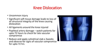 Knee Dislocation
• Uncommon injury
• Significant soft tissue damage leads to loss of
all structural integrity of the knee causing
dislocation
• All ligaments around the knee injured
• Popliteal artery damage – watch patients for
upto 72 hours to check for late vascular
compromise
• Reduce and apply cylindrical slab x 2weeks
and observe for signs of vascular compromise
for upto 72 hrs
 
