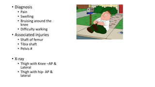 • Diagnosis
• Pain
• Swelling
• Bruising around the
knee
• Difficulty walking
• Associated injuries
• Shaft of femur
• Tibia shaft
• Pelvis #
• X-ray
• Thigh with Knee –AP &
Lateral
• Thigh with hip- AP &
lateral
 