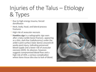Comprehensive Overview of Ankle Injuries: Ligaments, Fractures, and ...