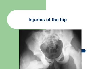 Injuries of the hip  