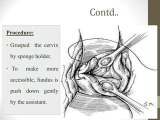 Contd..
Procedure:
• Grasped the cervix
by sponge holder.
• To make more
accessible, fundus is
push down gently
by the assistant.
 