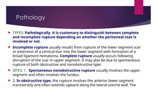 InjuriesToBirthCanal_OBG_125-127_2024_Final.pptx