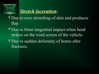 Injury | PPT