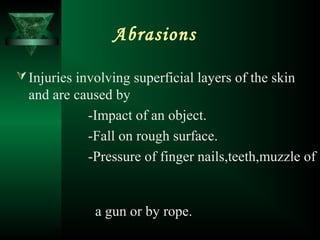 Injury | PPT