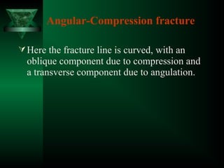 Angular-Compression fracture
Here the fracture line is curved, with an
oblique component due to compression and
a transverse component due to angulation.
 