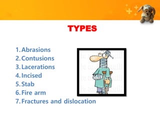Injury (Forensic science) | PPTX