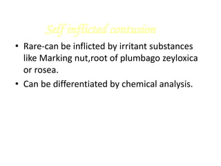 Self inflicted contusion
• Rare-can be inflicted by irritant substances
like Marking nut,root of plumbago zeyloxica
or rosea.
• Can be differentiated by chemical analysis.
 