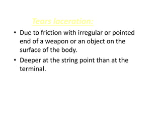 Tears laceration:
• Due to friction with irregular or pointed
end of a weapon or an object on the
surface of the body.
• Deeper at the string point than at the
terminal.
 