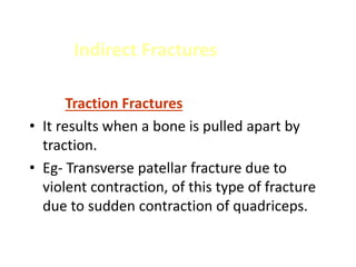 Indirect Fractures
Traction Fractures
• It results when a bone is pulled apart by
traction.
• Eg- Transverse patellar fracture due to
violent contraction, of this type of fracture
due to sudden contraction of quadriceps.
 