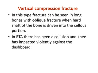 Vertical compression fracture
• In this type fracture can be seen in long
bones with oblique fracture when hard
shaft of the bone is driven into the cellous
portion.
• In RTA there has been a collision and knee
has impacted violently against the
dashboard.
 