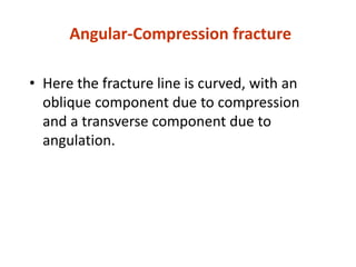 Angular-Compression fracture
• Here the fracture line is curved, with an
oblique component due to compression
and a transverse component due to
angulation.
 