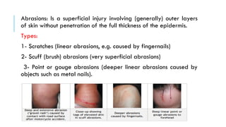 INJURY ASSESSMENT, CLASSIFICATION AND DOCUMENTATION.pptx