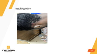 Comprehensive Injury Prevention in Tiles & Sanitaryware Industry ...