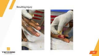 Comprehensive Injury Prevention in Tiles & Sanitaryware Industry ...