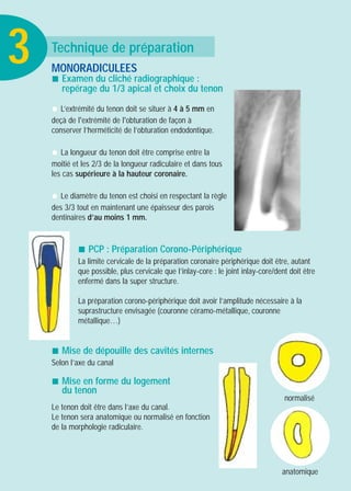 Technique de préparation
MONORADICULEES
! Examen du cliché radiographique :
repérage du 1/3 apical et choix du tenon
" L’extrémité du tenon doit se situer à 4 à 5 mm en
deçà de l'extrémité de l'obturation de façon à
conserver l’herméticité de l’obturation endodontique.
" La longueur du tenon doit être comprise entre la
moitié et les 2/3 de la longueur radiculaire et dans tous
les cas supérieure à la hauteur coronaire.
" Le diamètre du tenon est choisi en respectant la règle
des 3/3 tout en maintenant une épaisseur des parois
dentinaires d’au moins 1 mm.
! PCP : Préparation Corono-Périphérique
La limite cervicale de la préparation coronaire périphérique doit être, autant
que possible, plus cervicale que l’inlay-core : le joint inlay-core/dent doit être
enfermé dans la super structure.
La préparation corono-périphérique doit avoir l’amplitude nécessaire à la
suprastructure envisagée (couronne céramo-métallique, couronne
métallique…)
! Mise de dépouille des cavités internes
Selon l’axe du canal
! Mise en forme du logement
du tenon
Le tenon doit être dans l’axe du canal.
Le tenon sera anatomique ou normalisé en fonction
de la morphologie radiculaire.
anatomique
normalisé
3
 
