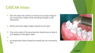 CADCAM Inlays
 This will allow the camera to record an accurate image of
the cavosurface margin while providing strength to the
restoration.
 Bevels and knife-edge margins should not be used.
 The cavity walls of the proximal box should have at least 6
to 8 degrees of divergent taper.

 All preparation floors should be smooth but not necessarily
flat.
SUMMIT
 