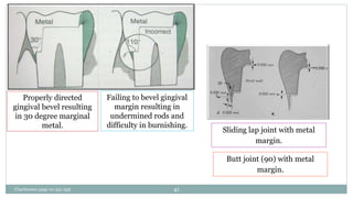 Failing to bevel gingival
margin resulting in
undermined rods and
difficulty in burnishing.
Butt joint (90) with metal
margin.
Sliding lap joint with metal
margin.
Properly directed
gingival bevel resulting
in 30 degree marginal
metal.
Charbeneau page no 351-359 41
 