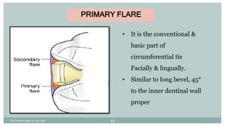 PRIMARY FLARE
• It is the conventional &
basic part of
circumferential tie
Facially & lingually.
• Similar to long bevel, 45°
to the inner dentinal wall
proper
Charbeneau page no 351-359 43
 