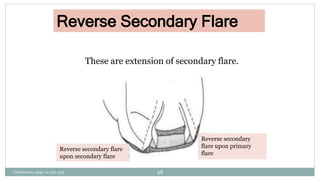 Reverse Secondary Flare
These are extension of secondary flare.
Reverse secondary flare
upon secondary flare
Reverse secondary
flare upon primary
flare
Charbeneau page no 351-359 48
 