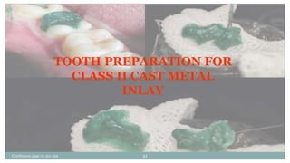 TOOTH PREPARATION FOR
CLASS II CAST METAL
INLAY
Charbeneau page no 351-359 51
 