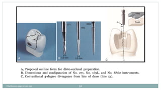 A, Proposed outline form for disto-occlusal preparation.
B, Dimensions and configuration of No. 271, No. 169L, and No. 8862 instruments.
C, Conventional 4-degree divergence from line of draw (line xy).
Charbeneau page no 351-359 52
 