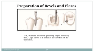D–F, Diamond instrument preparing lingual secondary
flare. Large arrow in F indicates the direction of the
translation.
Preparation of Bevels and Flares
Charbeneau page no 351-359 72
 