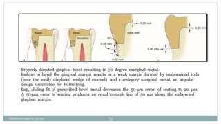 Properly directed gingival bevel resulting in 30-degree marginal metal.
Failure to bevel the gingival margin results in a weak margin formed by undermined rods
(note the easily displaced wedge of enamel) and 110-degree marginal metal, an angular
design unsuitable for burnishing.
Lap, sliding fit of prescribed bevel metal decreases the 50-µm error of seating to 20 µm.
A 50-µm error of seating produces an equal cement line of 50 µm along the unbeveled
gingival margin.
Charbeneau page no 351-359 73
 