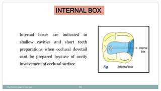 INTERNAL BOX
Internal boxes are indicated in
shallow cavities and short teeth
preparations when occlusal dovetail
cant be prepared because of cavity
involvement of occlusal surface.
Charbeneau page no 351-359 81
 