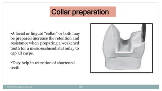 Collar preparation
•A facial or lingual “collar” or both may
be prepared increase the retention and
resistance when preparing a weakened
tooth for a mesioocclusodistal onlay to
cap all cusps.
•They help in retention of shortened
teeth.
Charbeneau page no 351-359 86
 