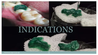 INDICATIONS
Charbeneau page no 351-359 9
 