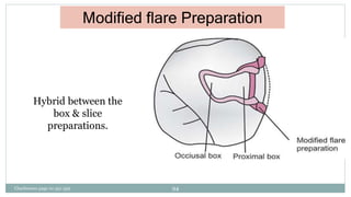 Modified flare Preparation
Hybrid between the
box & slice
preparations.
Charbeneau page no 351-359 94
 