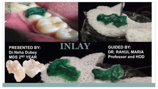 INLAY
PRESENTED BY:
Dr.Neha Dubey
MDS 2ND YEAR
1
GUIDED BY:
DR. RAHUL MARIA
Professor and HOD
 