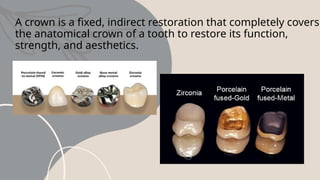 inlay onlay.pptxSampleMAXILOFACIALSampleMAXILOFACIAL | PPTX