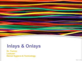 Inlays & Onlays
Dr. Yumna
Lecturer
Dental Hygiene & Technology
 