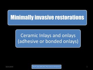 Minimally invasive restorations
Ceramic Inlays and onlays
(adhesive or bonded onlays)
10/21/2019 Sherif sultan,BDS,MsC,PhD,Fixed prosthodontics 1
 