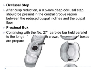  Occlusal Step
 After cusp reduction, a 0.5-mm deep occlusal step
should be present in the central groove region
between the reduced cuspal inclines and the pulpal
floor
 Proximal Box
 Continuing with the No. 271 carbide bur held parallel
to the long axis of the tooth crown, the proximal boxes
are prepared
 